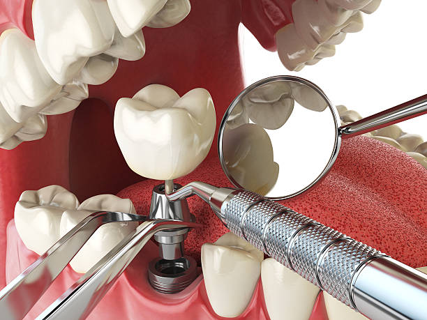 Best Weekend Emergency Dentist in Knightdale, NC